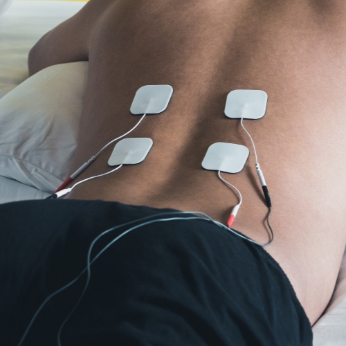 TENS-transcutaneous-electrical-nerve-stimulation-Retrieve-Physiotherapy-Mississauga-ON